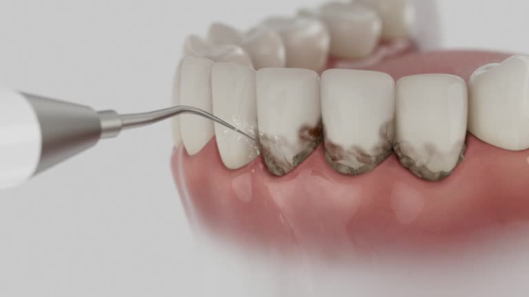 Reliable Dental contractor in Paris, MO by Smile Center Dentistry